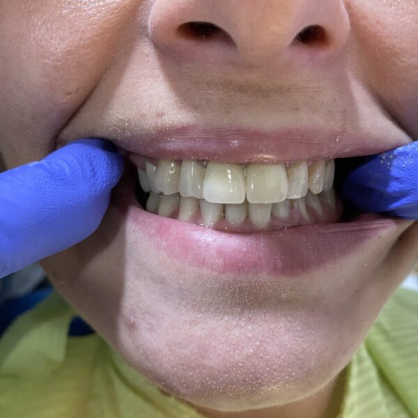 IMG 8012709230829cd62bb066ae467056b1 V