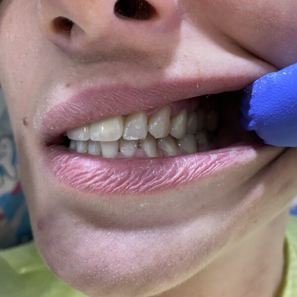 IMG 98d3a54850737c71978c68b88e6498b8 V