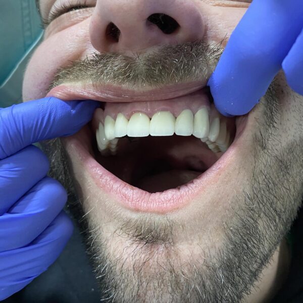 IMG a8f9a59c912c49c1f3d6fde8c5374acf V