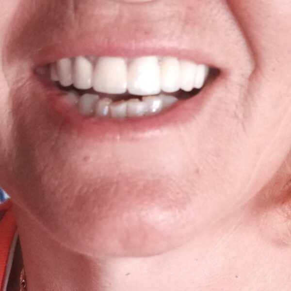 IMG befb90174290e272b3f137874de4ac99 V